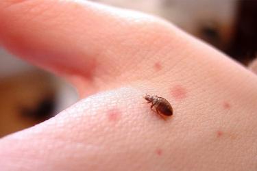 Чем опасны клопы и их укусы для человека?